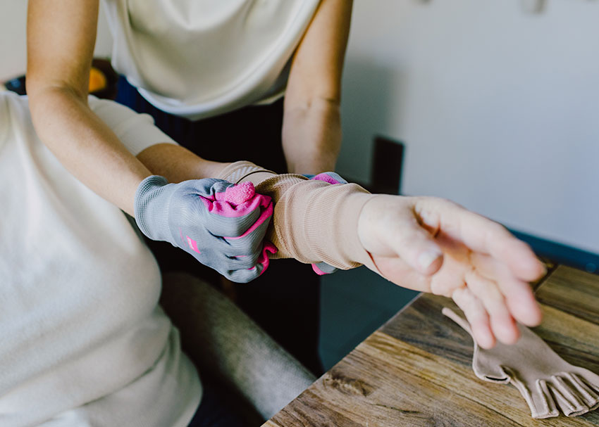 Anlegen einer medizinischen Kompressionsversorgung für den Arm bei Lymphödem